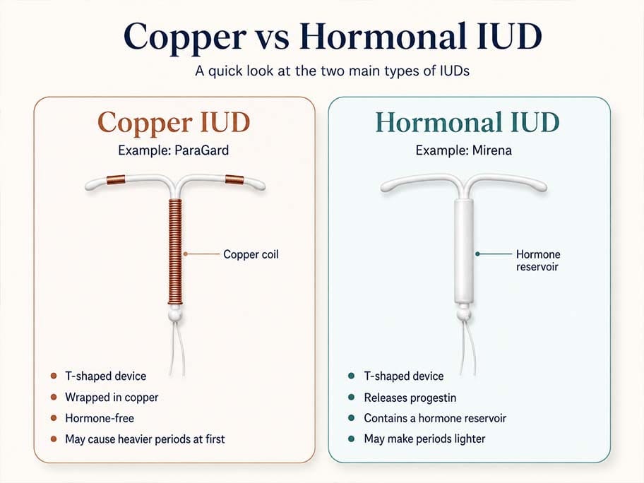 Side-by-side comparison of copper and hormonal IUDs